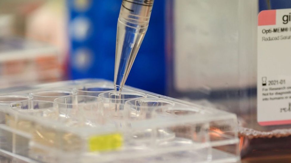 Korona virus i imunitet: Zagonetne T-ćelije možda pružaju skriveni imunitet na Kovid-19 5 Iako su antitela i dalje važna u cilju praćenja širenja Kovida-19, možda nas naposletku neće ona spasiti