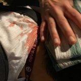 Reporteru nova.rs huligani razbili glavu 12