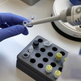 Direktor IZJZ: Institut nikada nije prestajao sa testiranjem, do sada urađeno 3.000 PCR analiza 4
