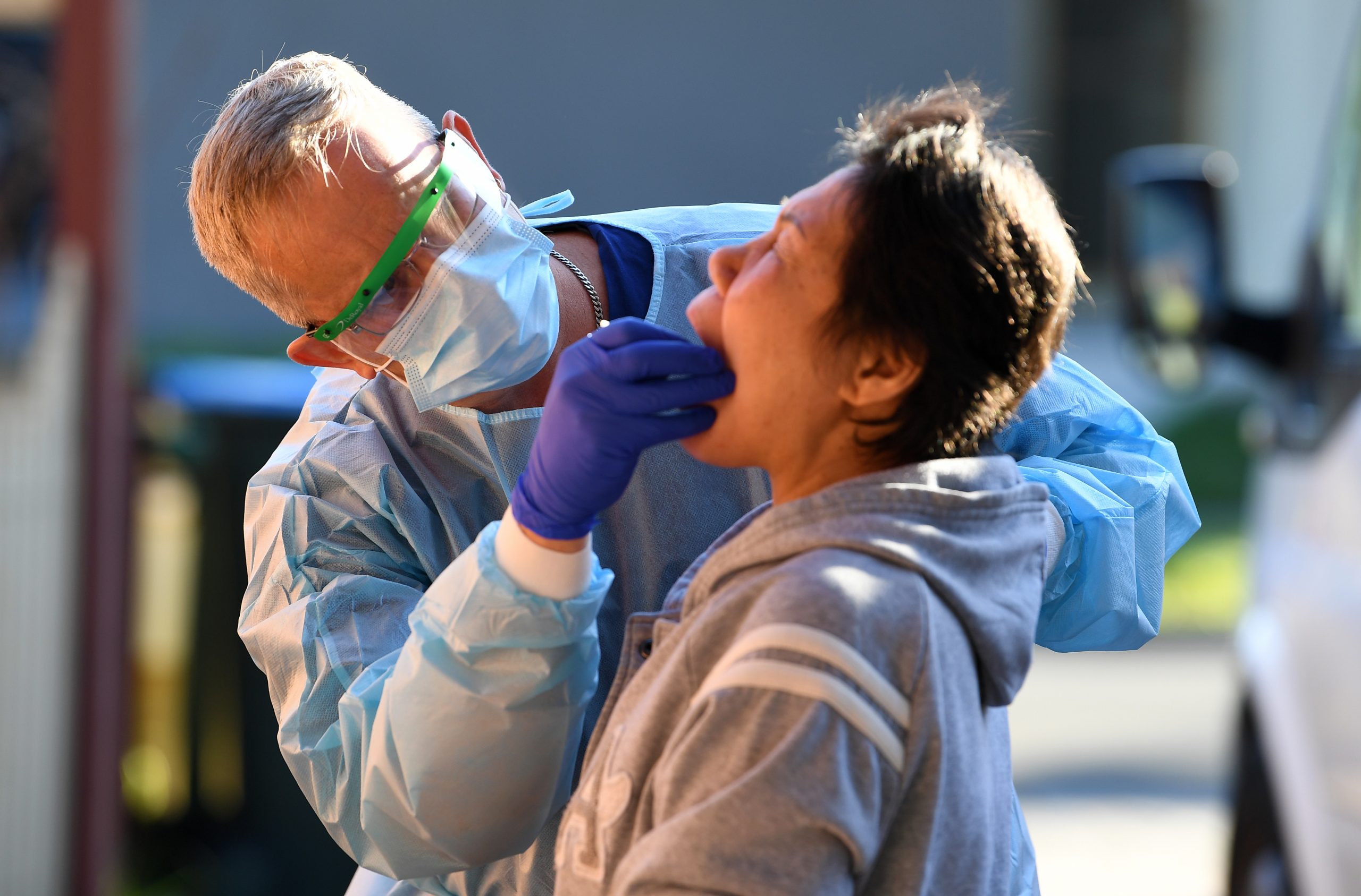 Najveći broj umrlih u danu - 13, još 299 obolelih i ukupno 110 na respiratoru 1