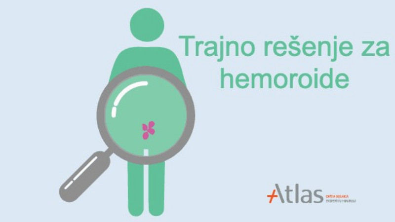 Efikasno rešenje za hemoroide - operacija THD metodom 1