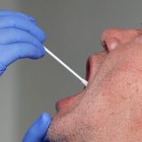 Otvorene dodatne laboratorije za testiranje na lični zahtev 5