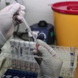 Od 14 testiranih uzoraka jedan pozitivan na virus korona u Pirotskom okrugu 2