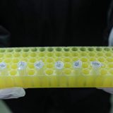 Samo jedan putnik verovatno izvor zaraze svih na brodu "Dajmond prinses" 6