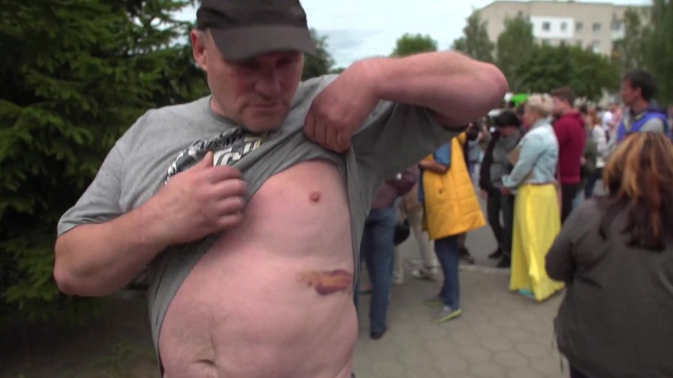 Izbori u Belorusiji: EU ne priznaje rezultate izbora, poziva na dijalog i najavljuje sankcije, opozicija najavljuje nove izbore za jesen 8 Man shows BBC his bruising outside Okrestina centre