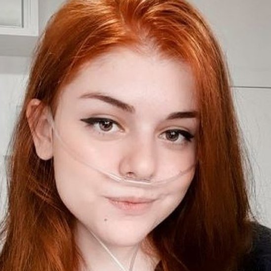 Zdravlje i retke bolesti: „Prestala sam da jedem pre dve godine, ali nisam revoltirana sopstvenim stanjem“ 6 Fernanda