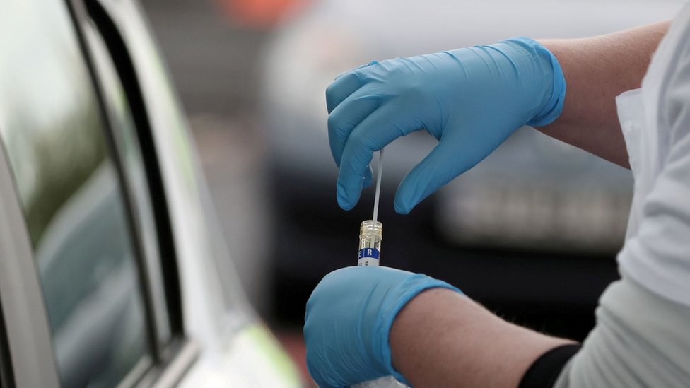 Korona virus: U Srbiji preminula još jedna osoba, Velika Britanija zabranjuje okupljanje više od šestoro ljudi, virus se najbrže širi u Indiji 4 Covid19 testing