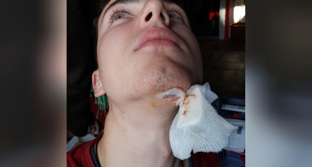 Porodica prebijenog mladića traži kazne za policajce 1