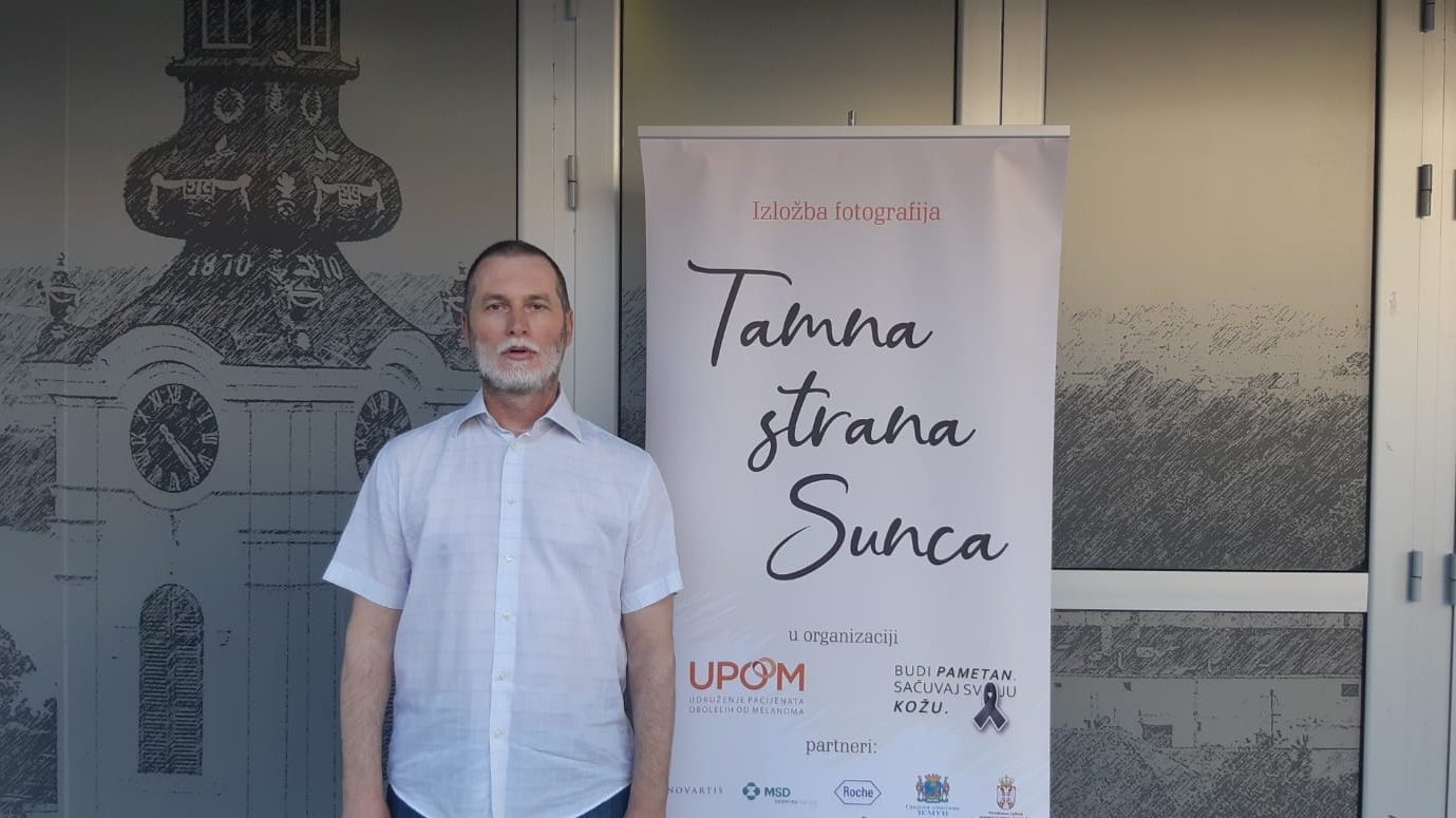 Lečenje melanoma za vreme pandemije  1