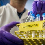 Eparhija: Vladika Joanikije pozitivan na korona virus, ima blagu upalu pluća 3