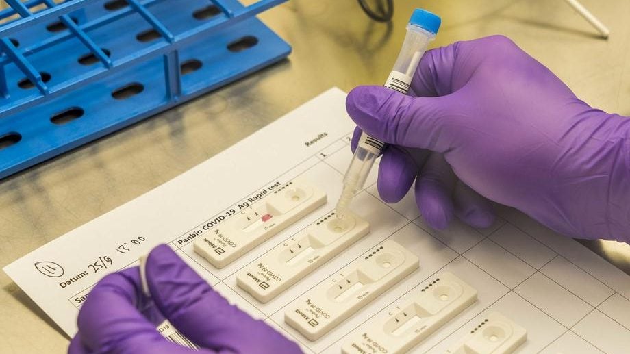 Na Kosovo samo uz PCR test 1