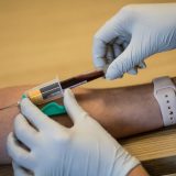 Vakcine i testovi za koronu u EU bez poreza na dodatu vrednost 14