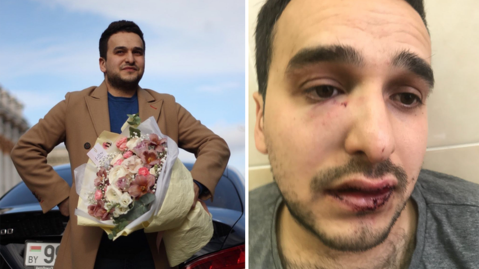 Maksim Khoroshyn seen before and after receiving injuries