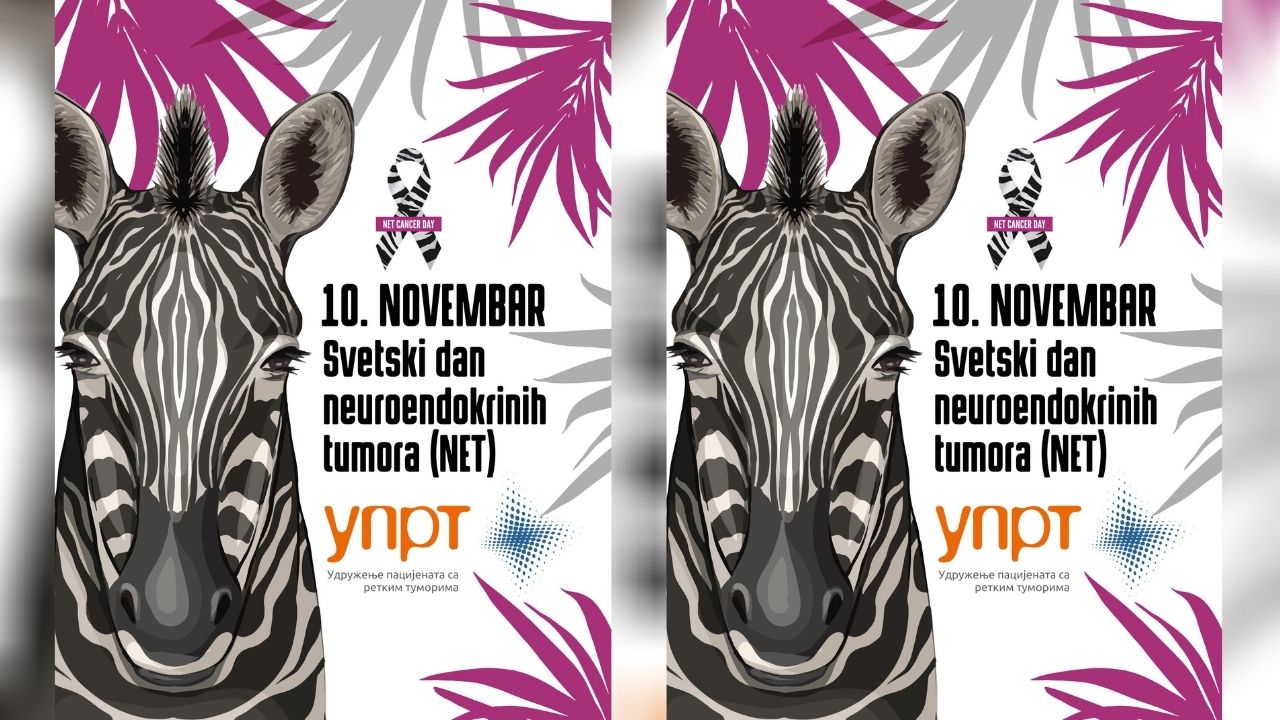 Neuroendokrini tumori se kasno otkrivaju, godišnje oboli do 100 osoba 1