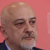 Panić: Mehaničku ventilaciju ne preživi 80 odsto pacijenata 3