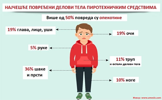 Povrede pirotehničkim sredstvima - Novogodišnji izazov koji nam nije potreban 2