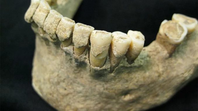Šta zubni kamenac otkriva o navikama drevnih ljudi 1