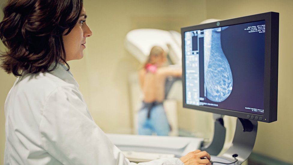 Svetski dan borbe protiv raka: „Korona virusa sam se plašila više nego oba karcinoma“ 4 Mammogram