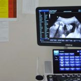Domu zdravlja u Boru ultrazvučni aparat najnovije generacije 2