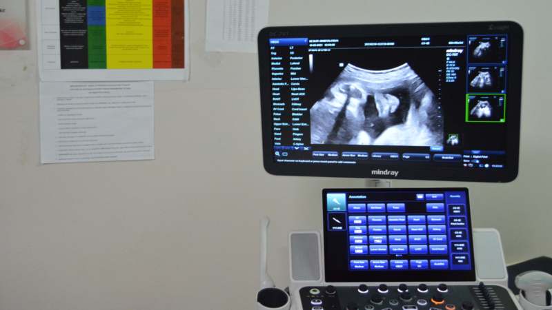 Domu zdravlja u Boru ultrazvučni aparat najnovije generacije 1