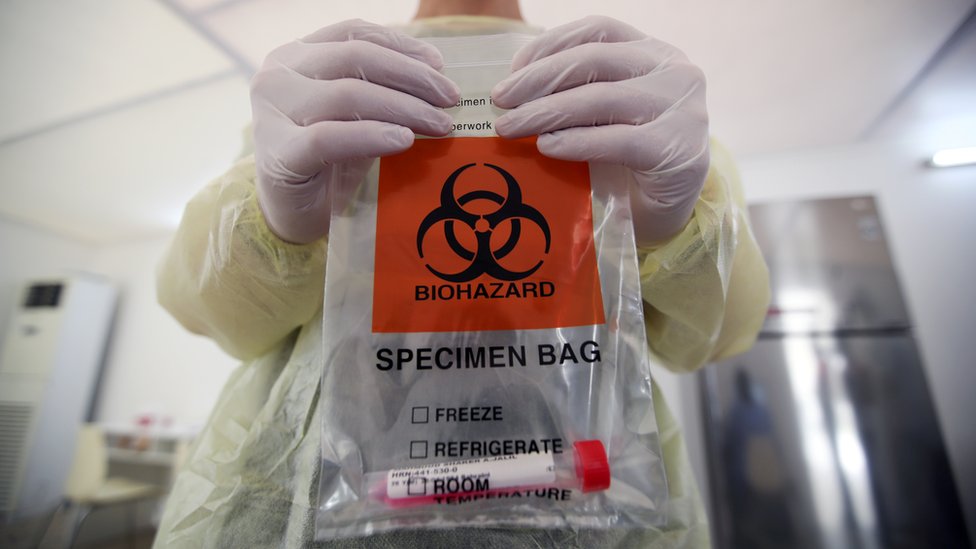 Korona virus i životna sredina: Kako se rešava problem medicinskog otpada u zdravstvu 4 Hands holding a plastic bag with a vial in it