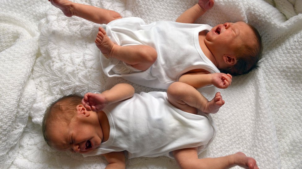 Roditelji i Srbija: Kako sam saznala da mi dete ima Daunov sindrom 3 bebe