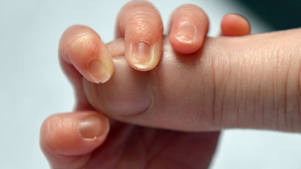 Roditelji i Srbija: Kako sam saznala da mi dete ima Daunov sindrom 6 bebina ruka