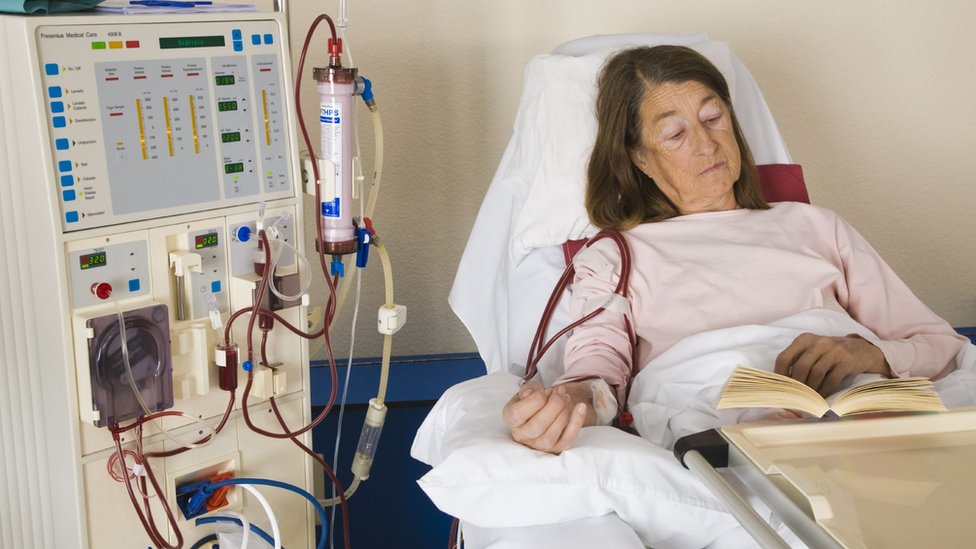 Korona virus i vakcinacija: „Odlučila sam da odem i kažem: Dobar dan, ja sam na dijalizi i želim vakcinu“ 1 dijaliza