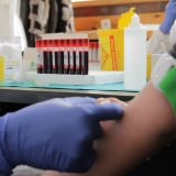 Vanredna akcija davanja krvi danas do 16 časova na Trgu slobode u Novom Sadu 1