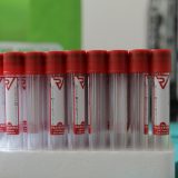 Institut: Rezerve krvi drastično smanjene, nedostaju sve grupe 8