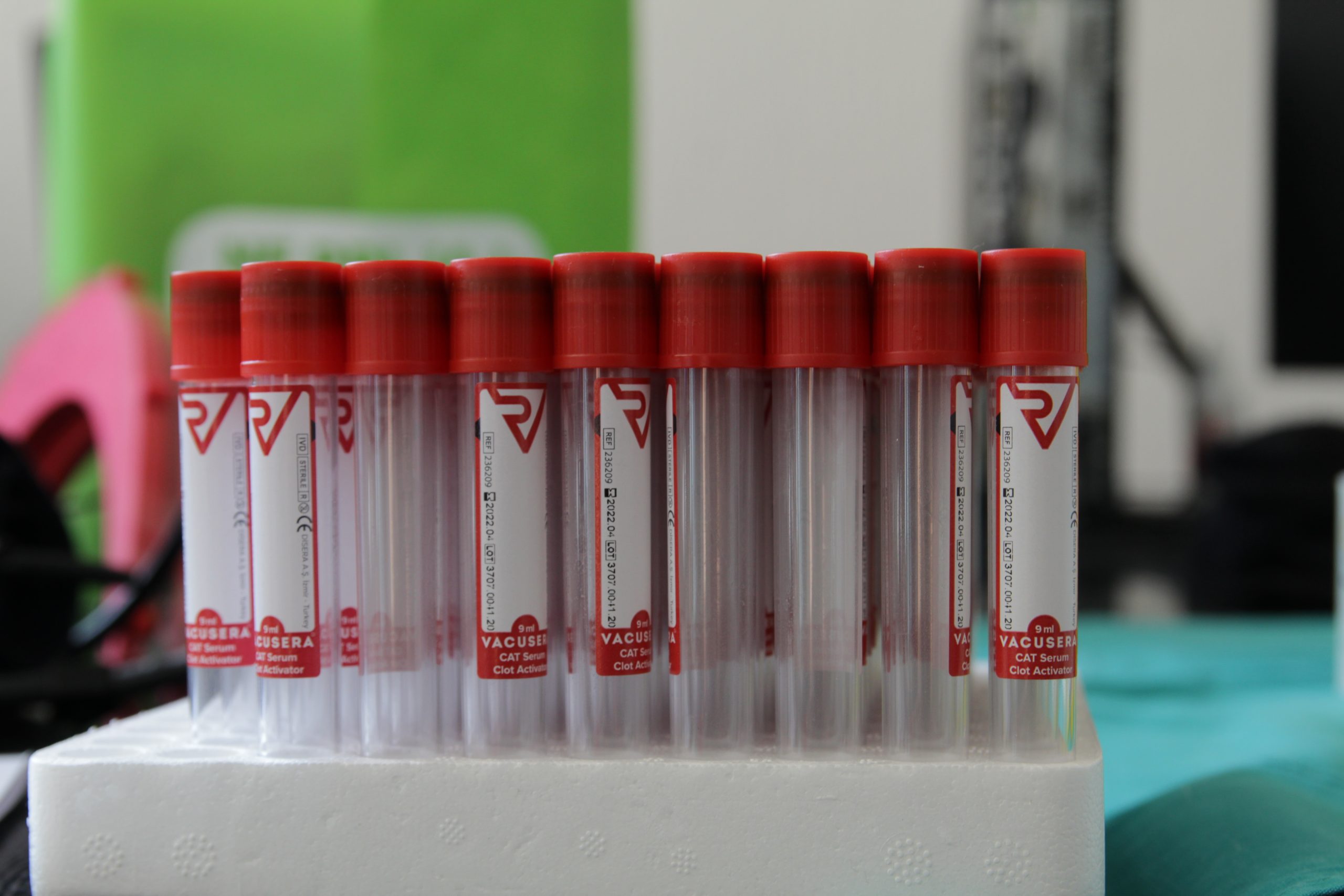 Institut: Rezerve krvi drastično smanjene, nedostaju sve grupe 1