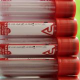 Još 186 novoobolelih u Braničevu i Podunavlju 5