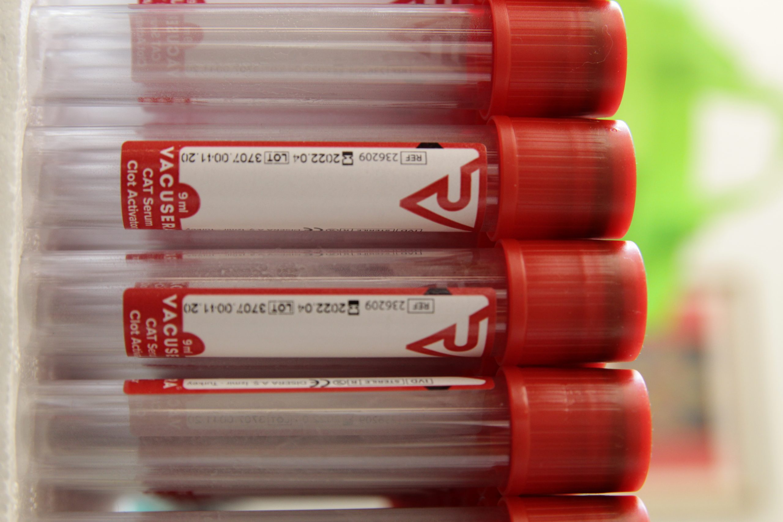 Još 186 novoobolelih u Braničevu i Podunavlju 1