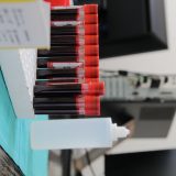 Najviše vakcinisanih u Užicu, najmanje u Sjenici  14