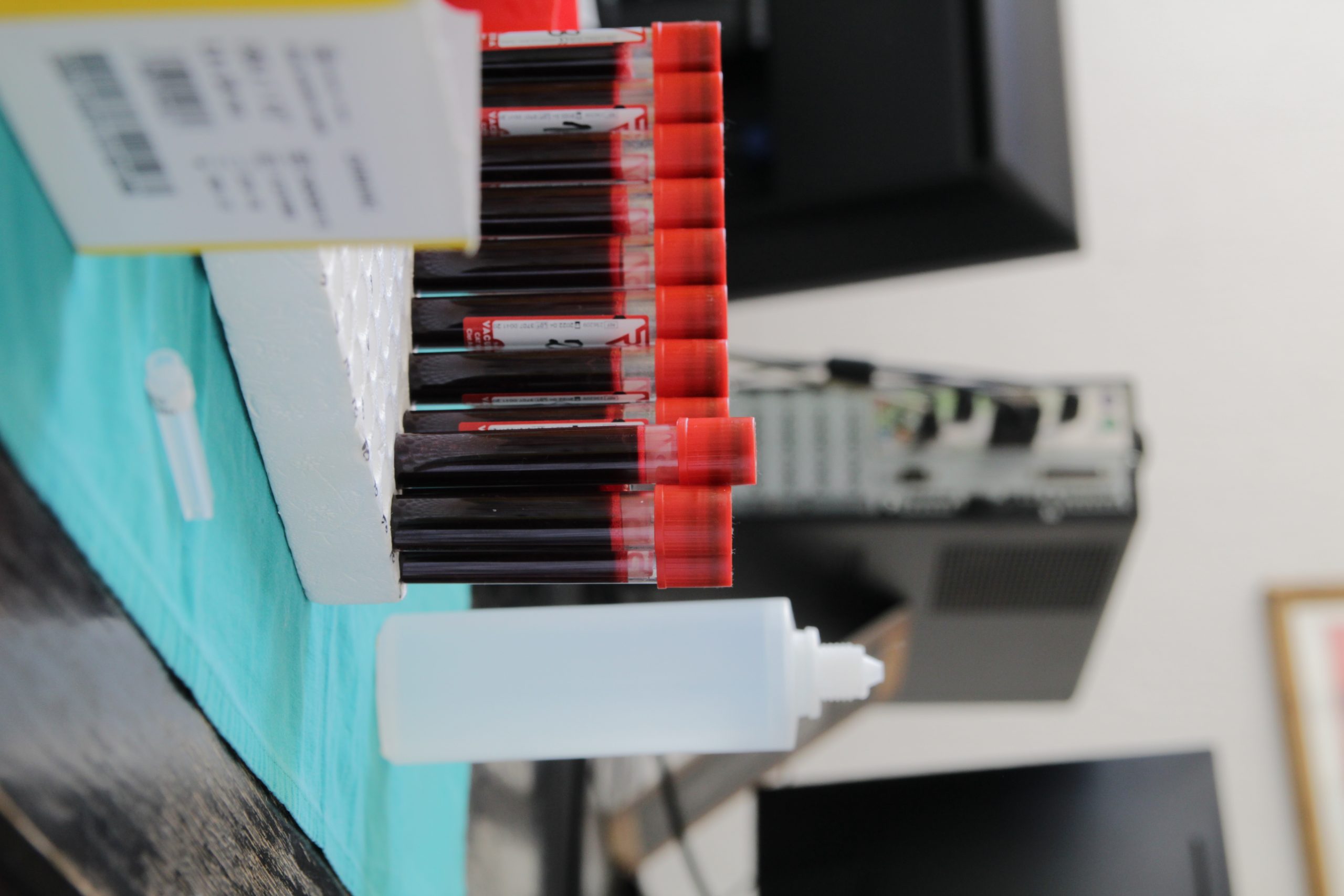 Najviše vakcinisanih u Užicu, najmanje u Sjenici  1