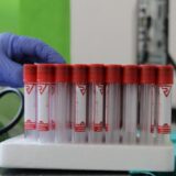 Opština Gadžin Han proglasila vanrednu situaciju zbog epidemije korona virusa 13