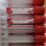 Za mesec dana skoro duplo više novih slučajeva u užičkom regionu 3