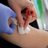 U Novom Sadu besplatne analize krvi za sve dobrovoljne davaoce 11