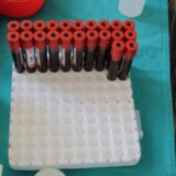 Delta soj korona virusa 60 odsto zarazniji 3