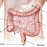 Koji su simptomi raka debelog creva: U Srbiji se svaki četvrti pacijent kasno javi lekaru 8
