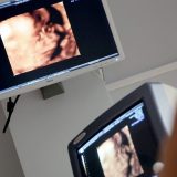 Zašto parovi iz Srbije ne mogu da poklone preostale embrione? 2