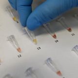 Profesorka Hemijskog fakulteta: U Srbiji se razvija domaći antigenski test na korona virus 5