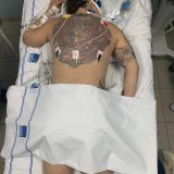 Korona virus i Brazil: „Zašto sam na mrežama podelila slike kako se borim za život protiv Kovida-19" 6
