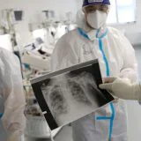 Dugotrajne tegobe nakon kovida ima između 40 i 50 odsto pacijenata 8