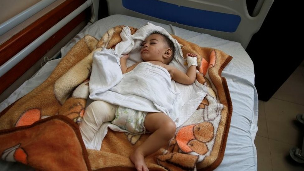 Izrael, Palestina i nasilje: Napadi na gazu nastavljaju se „punom snagom“, kaže Netanjahu 7 Palestinian infant boy Omar Al-Hadidi lies on a hospital bed after Gaza health officials said an Israeli missile struck a house, killing his mother and four siblings, in Gaza City May 15, 2021