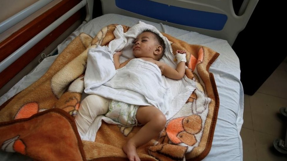 Palestinian infant boy Omar Al-Hadidi lies on a hospital bed after Gaza health officials said an Israeli missile struck a house, killing his mother and four siblings, in Gaza City May 15, 2021