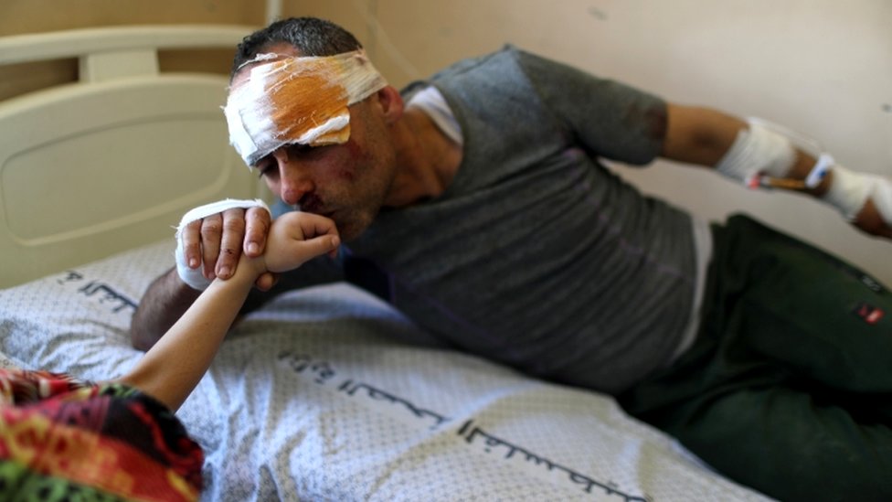 Riyad Eshkuntana kisses his daughter Suzy"s hand as they are treated at a hospital after being pulled from the rubble