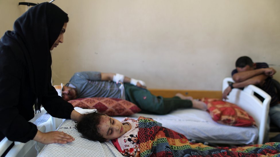 Riyad Eshkuntana lies next to his daughter in hospital