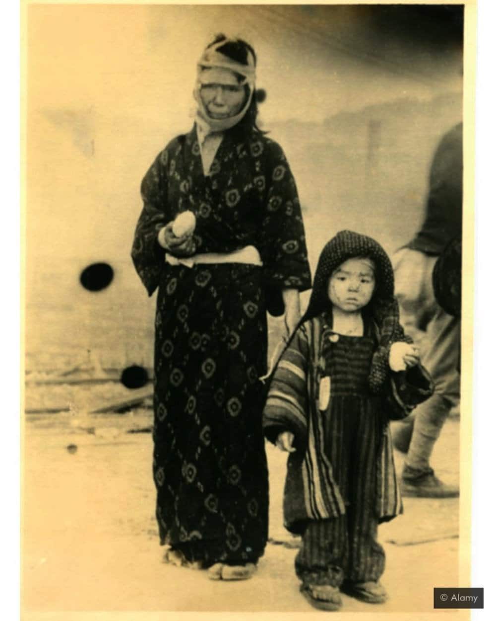 Hirošima i Nagasaki: Može li nuklearni rat biti moralno opravdan 2 preživeli u nuklearnom napadu na japan