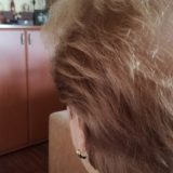 Korona virus i opadanje kose: „Samo da ne oćelavim i ne nosim periku" 5